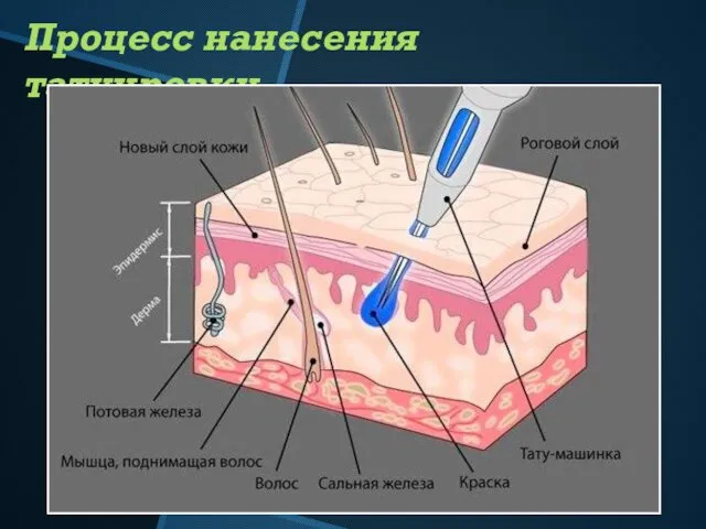 Процесс нанесения татуировки