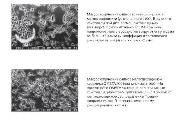 Микроскопический снимок конвенциональной металлокерамики (увеличение: х 1000). Видно, что кристаллы лейцита
