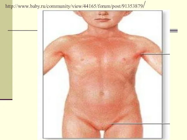 http://www.baby.ru/community/view/44165/forum/post/91353879/