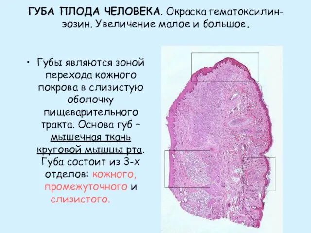 ГУБА ПЛОДА ЧЕЛОВЕКА. Окраска гематоксилин-эозин. Увеличение малое и большое. Губы являются