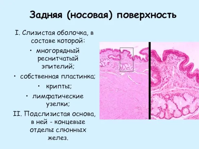 Задняя (носовая) поверхность I. Слизистая оболочка, в составе которой: многорядный реснитчатый