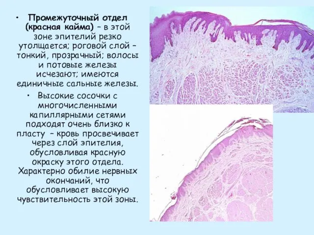 Промежуточный отдел (красная кайма) – в этой зоне эпителий резко утолщается;