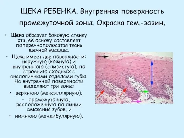 ЩЕКА РЕБЕНКА. Внутренняя поверхность промежуточной зоны. Окраска гем.-эозин. Щека образует боковую