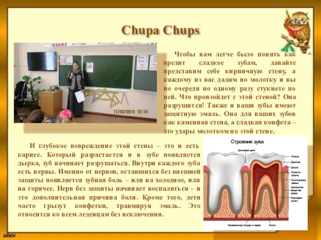 Chupa Chups Чтобы вам легче было понять как вредит сладкое зубам,