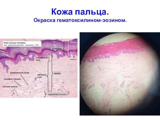 Кожа пальца. Окраска гематоксилином-эозином.