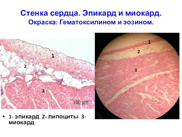 Стенка сердца. Эпикард и миокард. Окраска: Гематоксилином и эозином. 1- эпикард