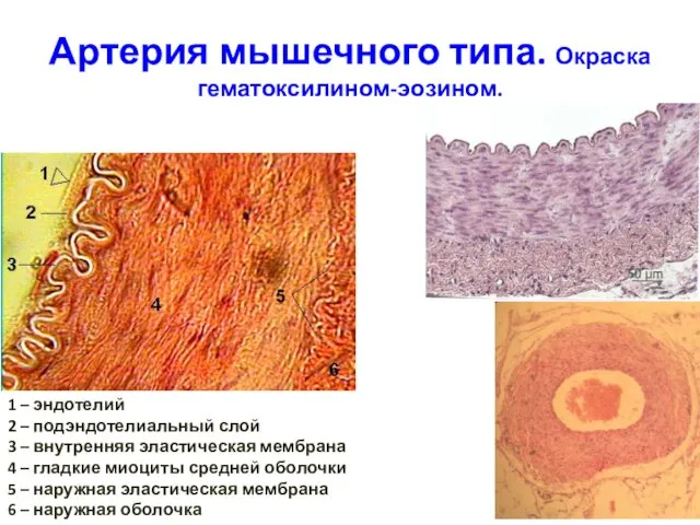 Артерия мышечного типа. Окраска гематоксилином-эозином. 1 – эндотелий 2 – подэндотелиальный