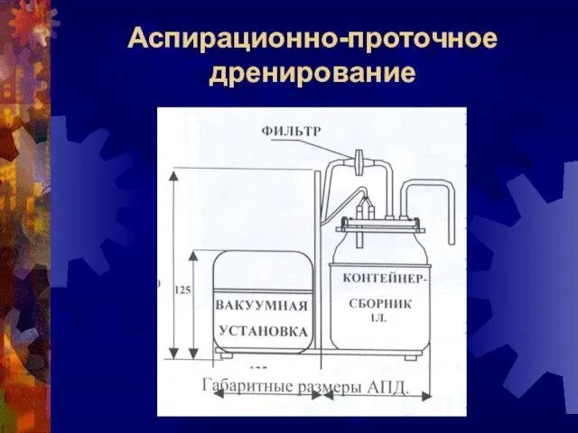 Аспирационно-проточное дренирование