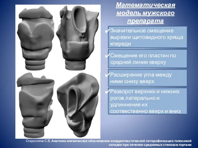 Математическая модель мужского препарата гортани Значительное смещение вырезки щитовидного хряща кпереди