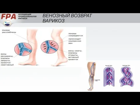 ВЕНОЗНЫЙ ВОЗВРАТ ВАРИКОЗ