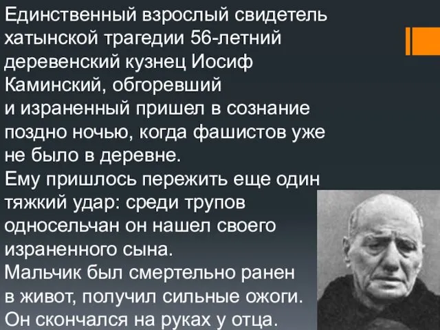 Единственный взрослый свидетель хатынской трагедии 56-летний деревенский кузнец Иосиф Каминский, обгоревший