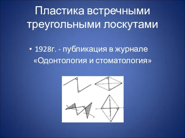 Пластика встречными треугольными лоскутами 1928г. - публикация в журнале «Одонтология и стоматология»