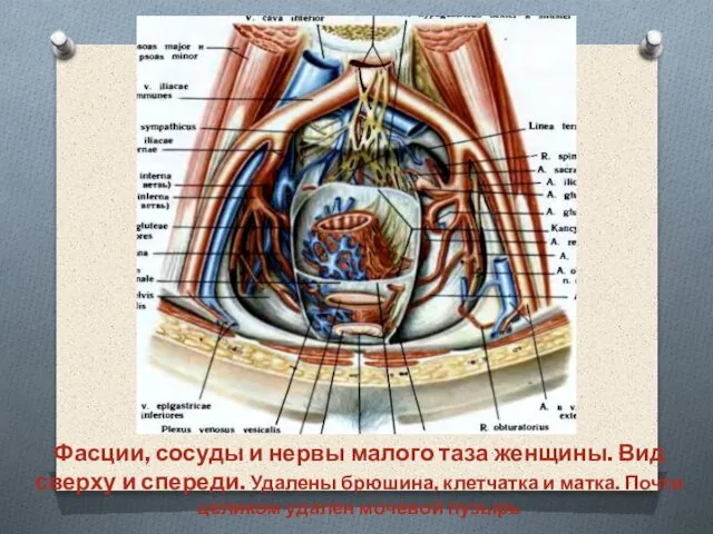 Фасции, сосуды и нервы малого таза женщины. Вид сверху и спереди.