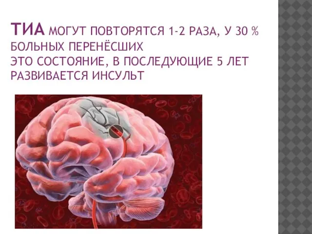 ТИА МОГУТ ПОВТОРЯТСЯ 1-2 РАЗА, У 30 % БОЛЬНЫХ ПЕРЕНЁСШИХ ЭТО