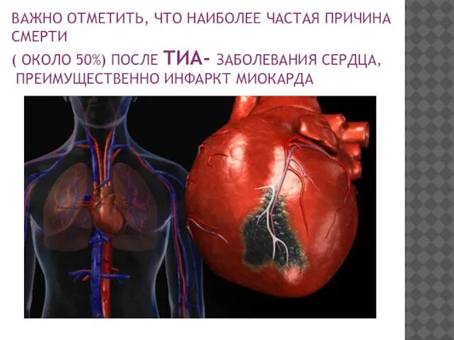 ВАЖНО ОТМЕТИТЬ, ЧТО НАИБОЛЕЕ ЧАСТАЯ ПРИЧИНА СМЕРТИ ( ОКОЛО 50%) ПОСЛЕ