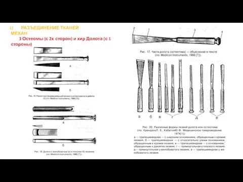 РАЗЪЕДИНЕНИЕ ТКАНЕЙ МЕХАН 3 Остеомы (с 2х сторон) и хир Долота (с 1 стороны)