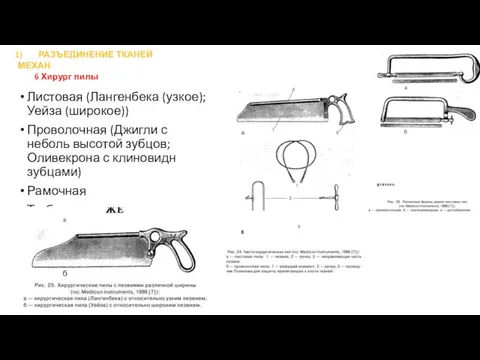 Листовая (Лангенбека (узкое); Уейза (широкое)) Проволочная (Джигли с неболь высотой зубцов;