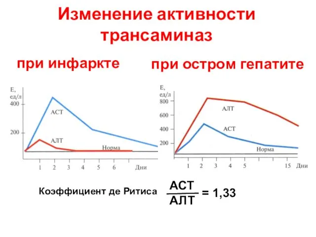 Изменение активности трансаминаз при инфаркте при остром гепатите Коэффициент де Ритиса АСТ АЛТ = 1,33