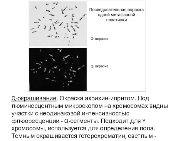 Q-окрашивание. Окраска акрихин-ипритом. Под люминесцентным микроскопом на хромосомах видны участки с