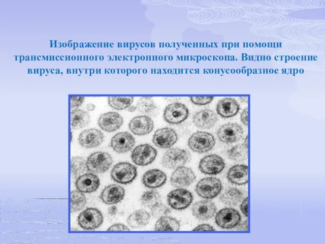 Изображение вирусов полученных при помощи трансмиссионного электронного микроскопа. Видно строение вируса, внутри которого находится конусообразное ядро