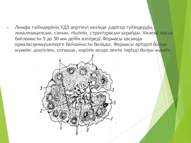 Лимфа түйіндерінің УДЗ зерттеуі кезінде дәрігер түйіндердің локализациясын, санын, пішінін, структурасын