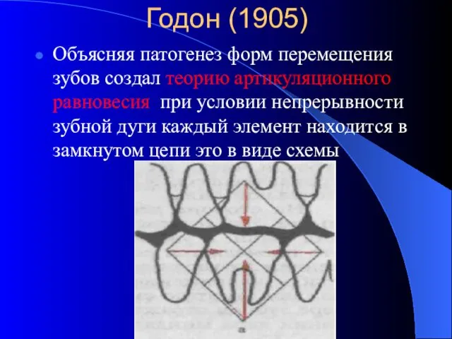 Годон (1905) Объясняя патогенез форм перемещения зубов создал теорию артикуляционного равновесия