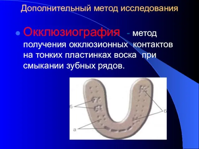 Дополнительный метод исследования Окклюзиография - метод получения окклюзионных контактов на тонких