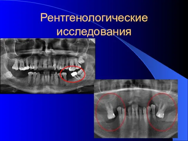 Рентгенологические исследования