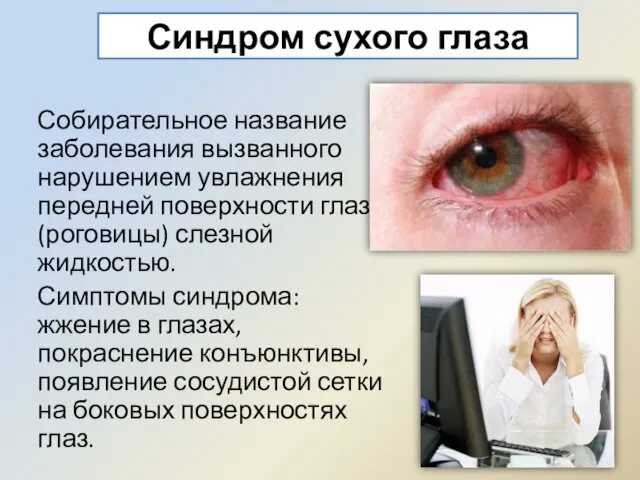 Синдром сухого глаза Собирательное название заболевания вызванного нарушением увлажнения передней поверхности