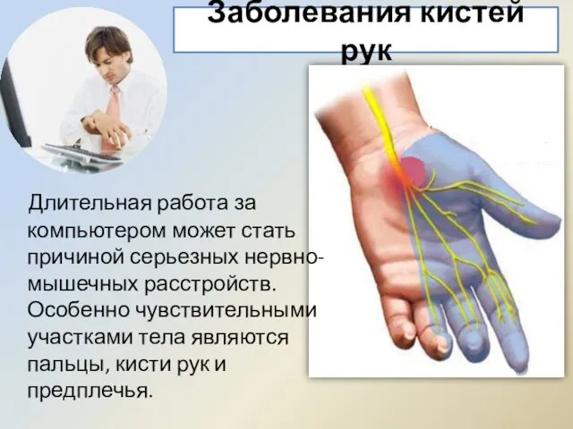 Заболевания кистей рук Длительная работа за компьютером может стать причиной серьезных