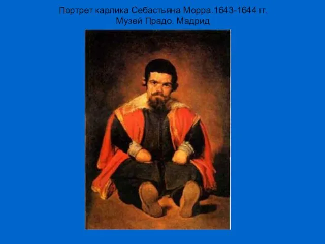 Портрет карлика Себастьяна Морра.1643-1644 гг. Музей Прадо. Мадрид