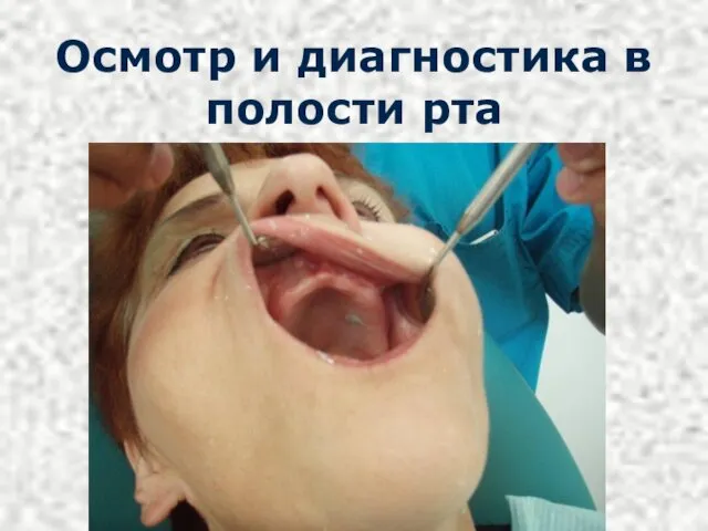 Осмотр и диагностика в полости рта