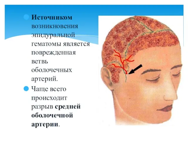 Источником возникновения эпидуральной гематомы является поврежденная ветвь оболочечных артерий. Чаще всего происходит разрыв средней оболочечной артерии.