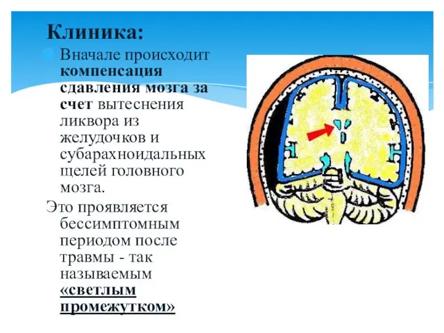 Клиника: Вначале происходит компенсация сдавления мозга за счет вытеснения ликвора из