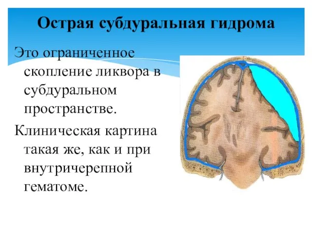 Острая субдуральная гидрома Это ограниченное скопление ликвора в субдуральном пространстве. Клиническая