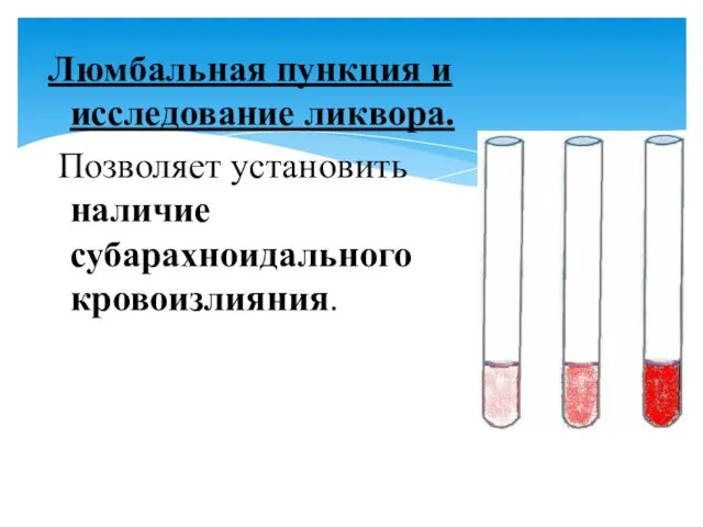 Люмбальная пункция и исследование ликвора. Позволяет установить наличие субарахноидального кровоизлияния.