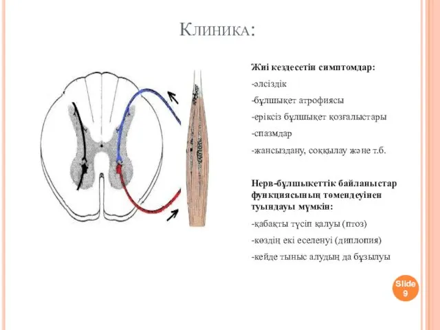 Клиника: Slide Жиі кездесетін симптомдар: -әлсіздік -бұлшықет атрофиясы -еріксіз бұлшықет қозғалыстары