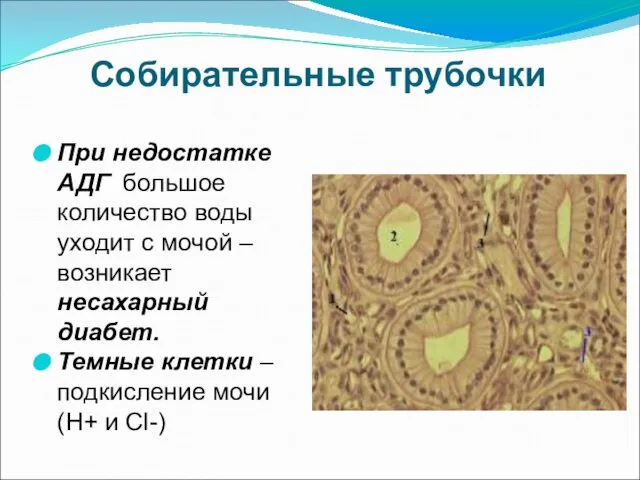 Собирательные трубочки При недостатке АДГ большое количество воды уходит с мочой