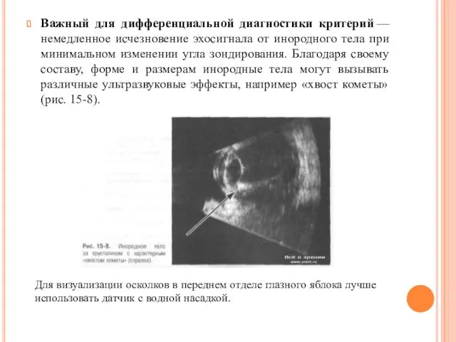 Важный для дифференциальной диагностики критерий — немедленное исчезновение эхосигнала от инородного