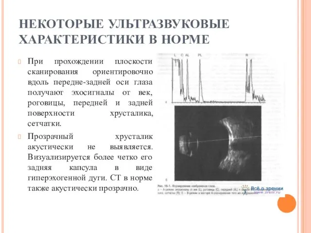 НЕКОТОРЫЕ УЛЬТРАЗВУКОВЫЕ ХАРАКТЕРИСТИКИ В НОРМЕ При прохождении плоскости сканирования ориентировочно вдоль