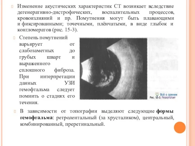 Изменение акустических характеристик СТ возникает вследствие дегенеративно-дистрофических, воспалительных процессов, кровоизлияний и