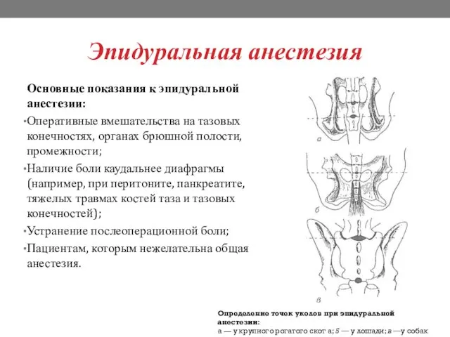 Эпидуральная анестезия Основные показания к эпидуральной анестезии: Оперативные вмешательства на тазовых