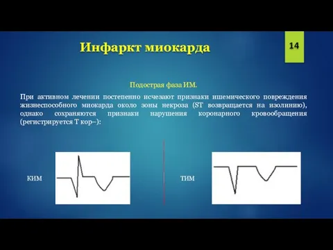 Инфаркт миокарда 14 Подострая фаза ИМ. При активном лечении постепенно исчезают