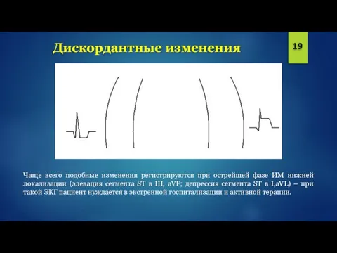 Дискордантные изменения 19 Чаще всего подобные изменения регистрируются при острейшей фазе