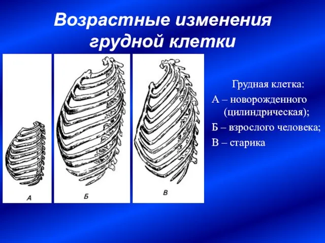 Возрастные изменения грудной клетки Грудная клетка: А – новорожденного (цилиндрическая); Б