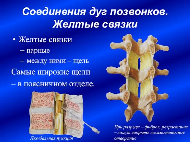 Соединения дуг позвонков. Желтые связки Желтые связки парные между ними –