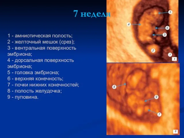 1 - амниотическая полость; 2 - желточный мешок (срез); 3 -