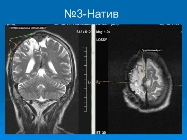 №3-Натив