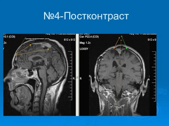 №4-Постконтраст