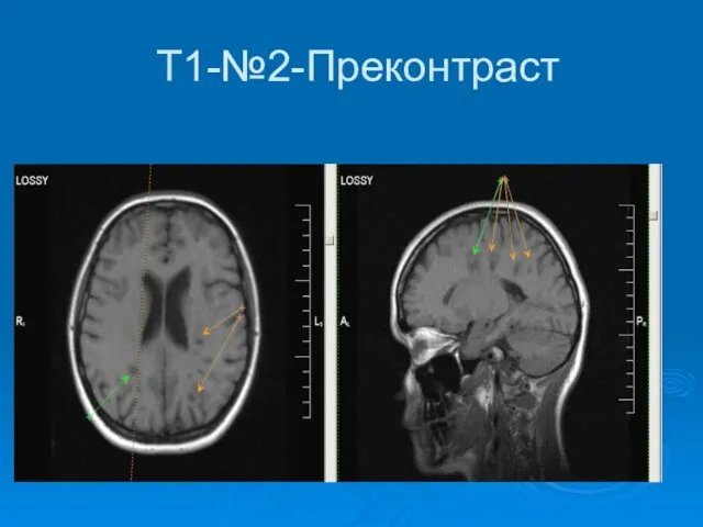 Т1-№2-Преконтраст